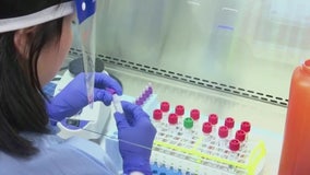 Long COVID could be aging organs faster by 3-4 years, research shows